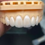 Dental Clinic jumber zoidze Bahn ბათუმში — გასართობი ობიექტი, მისამართი, ფასები | შენი ბათუმი