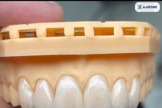 Dental Clinic jumber zoidze Dental Clinic jumber zoidze ბათუმში — სტომატოლოგიური კლინიკა, მისამართი, ფასები | შენი ბათუმი