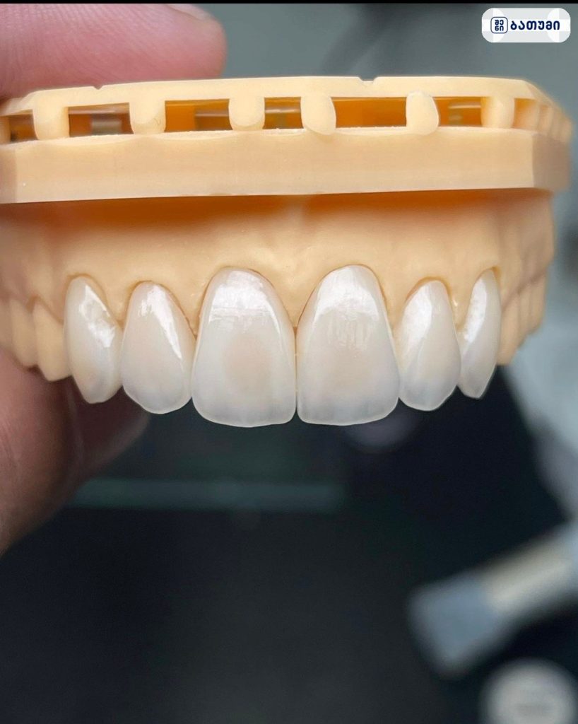 Dental Clinic jumber zoidze