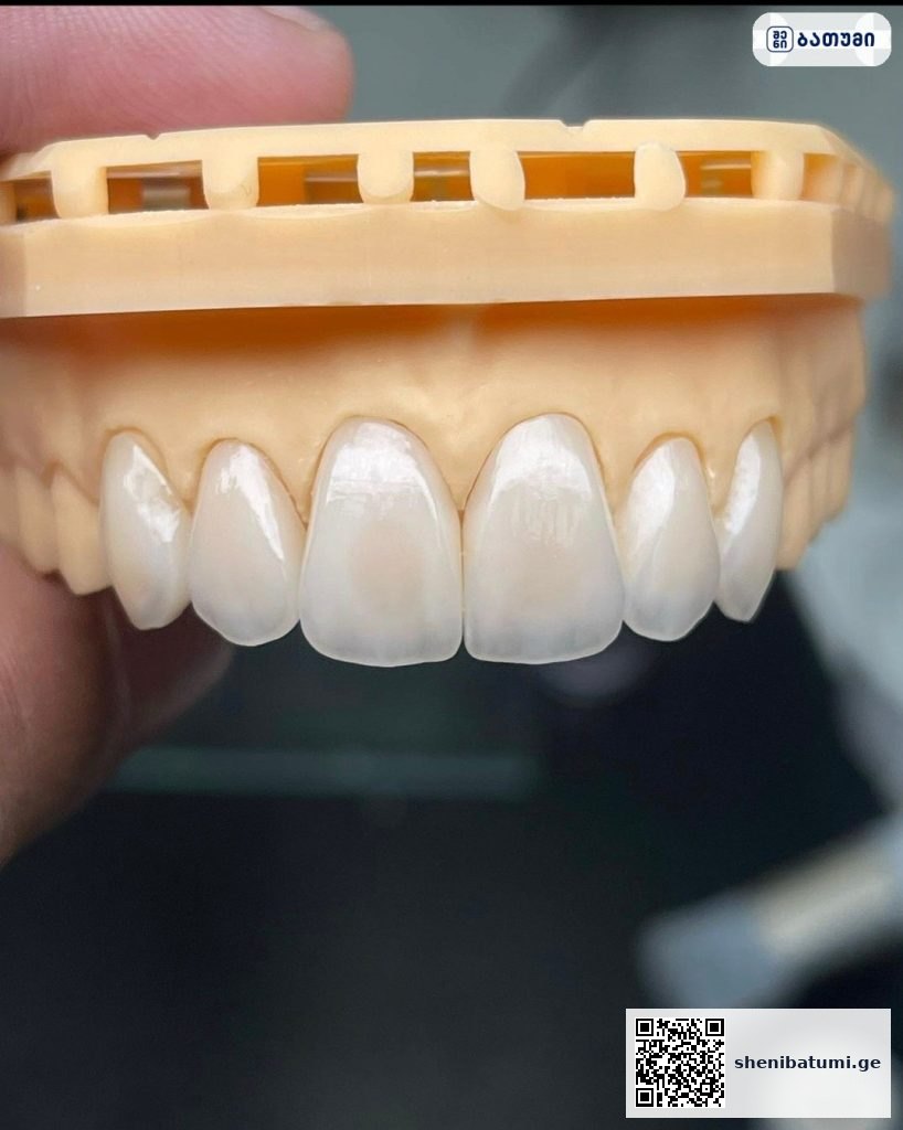 Dental Clinic jumber zoidze ბათუმში — სტომატოლოგიური კლინიკა, მისამართი, ფასები | შენი ბათუმი